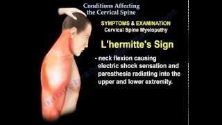 Conditions Affecting The Cervical Spine  Everything You Need To Know  Dr Nabil Ebraheim [upl. by Yonah]