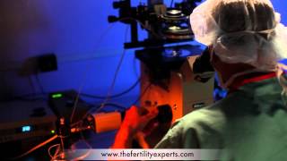 ICSI Procedure  IVF Intracytoplasmic Sperm Injection [upl. by Eugenio124]