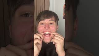 Do Teeth Whitening Strips Work lifestyle tiktok teethwhitening beauty wow selfcare [upl. by Alian]