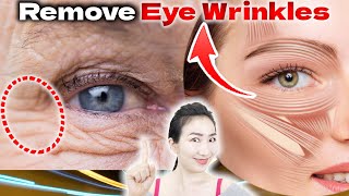 3 Essential Orbicularis Oculi Massages and Exercises to Remove Wrinkles Around the Eyes in 14 Days [upl. by Gusta]