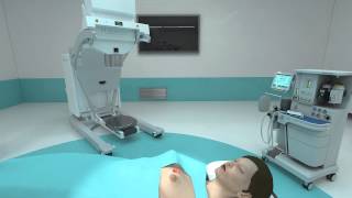 Mobetron®  Intraoperative Electron Radiation Therapy IORT [upl. by Retsam724]