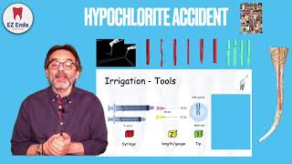 How to Avoid amp Treat the Hypochlorite Accident كيف نتجنب quotحادثة الهيبوكلوريتquot أثناء علاج العصب [upl. by Thill]