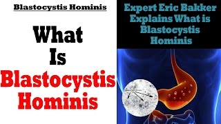 What Is Blastocystis Hominis  Ask Eric Bakker [upl. by Kylstra13]