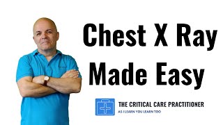 An EASY way to read the Chest X Ray [upl. by Treble]