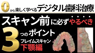 『デジ校③ 』スキャン前に必ずするべき３つのこと／ゼロからはじめるデジタル歯科治療 [upl. by Ennaed169]