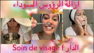 ازالة الرؤوس السوداء وتنظيف عميق للبشرة في المنزل les points noirssoin de visage [upl. by Yrffej233]