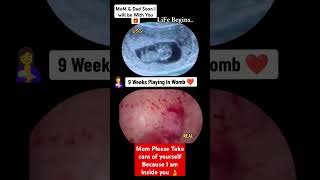 9 Weeks Baby Growing Inside Womb Pregnancy Ultrasound baby pregnancy babyboy babygirl boy [upl. by Alysia]