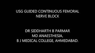 USG guided continuous femoral nerve block [upl. by Notserp905]