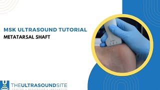 Musculoskeletal ultrasound evaluation of the metatarsal shaft [upl. by Glennon]