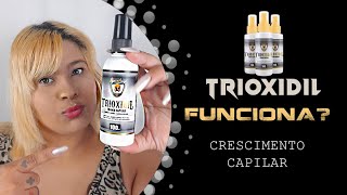 Trioxidil funciona Minha Experiência [upl. by Aisul]