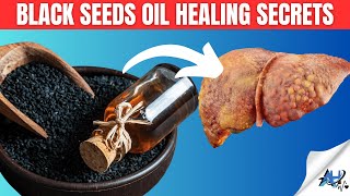 14 Black Seed Oil Benefits Youll Be Surprised To Know [upl. by Seana]