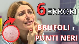 ELIMINARE BRUFOLI E PUNTI NERI 😱5 ERRORI CHE TUTTI FACCIAMO  E COME EVITARLI [upl. by Lavud]