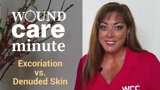 Whats the Difference Between Excoriation and Denuded Skin [upl. by Hedaza]