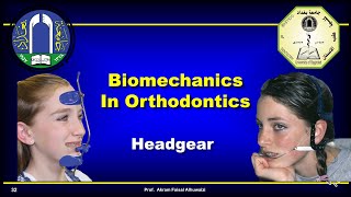 Use of headgear in Orthodontics [upl. by Eynenihc]