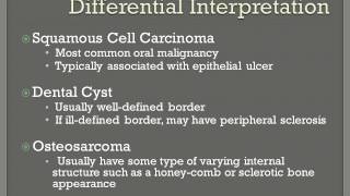 Fibrosarcoma [upl. by Eisler]