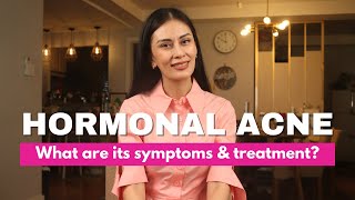 Hormonal Acne What are its Symptoms amp Treatment  Dr Gaile RobredoVitas [upl. by Madlin]