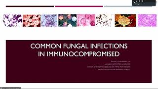 ๊quotUpdate guideline for Febrile neutropeniaquot and quotCommon Fungal Infections in Immunocompromisedquot [upl. by Feinstein]