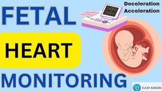 Fetal Heart Rate Monitoring Interpretation AccelerationDeceleration। EarlyVariableLate aiims [upl. by Lekzehcey]