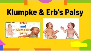 klumpke amp erbs palsy  waiters tip posture amp claw hand deformity physiotherapy knowledge [upl. by Leonie140]