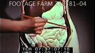 Penicillin in Medicine and Surgery 22058104mp4  Footage Farm [upl. by Airdnekal]