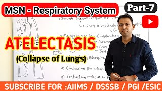 Atelectasis  causes symptoms pathophysiology treatment of atelectasis  respiratory msn part7 [upl. by Akenor]