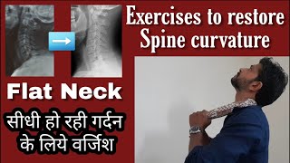 How to restore cervical curve  Exercises for straightening of cervical spineLoss of Lordosis [upl. by Yelnoc]