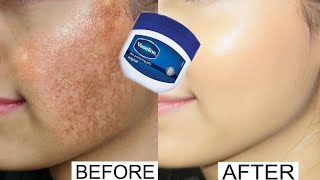 Vaseline for face pigmentation overnight  Vaseline on face at night benefits  Vaseline on face [upl. by Aldin634]