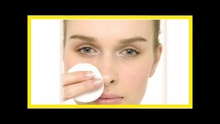 Como usar o creme clareador Hormoskin para melasma [upl. by Binnings793]