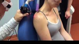 Laser Scar Removal in Richmond Va [upl. by Alan]