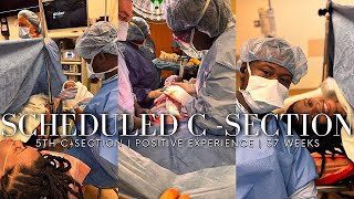 SCHEDULED CSECTION BIRTH VLOG  5th REPEAT C  SECTION  POSITIVE EXPERIENCE  LABOR AND DELIVERY [upl. by Betthezel]