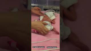 Prematüre Bebeğin Anne ile İlk Tensel Teması Kangaroo care for a 25weekold premature baby shorts [upl. by Presber531]