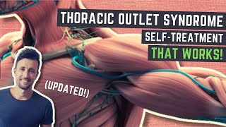 Thoracic Outlet Syndrome Treatment That WORKS Updated [upl. by Sido318]