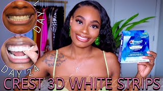 I Tried The Crest 3D White Strips for 24 Days  QuickAffordable Teeth Whitening  Before amp After [upl. by Philipines]