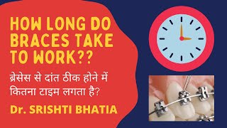 How long do braces take to work ब्रेसेस से दांत ठीक होने में कितना टाइम लगता है Dr Srishti Bhatia [upl. by Jaquiss]