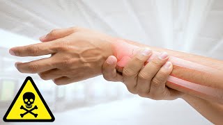 How to Tell What is Causing the Numbness in Your Hands 5 Common Causes [upl. by Anirehc]