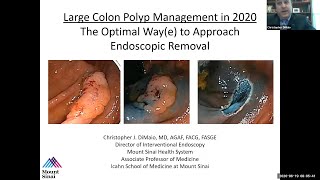 Large Colon Polyp Management in 2020 The Optimal Waye to Approach Endoscopic Removal [upl. by Nilad126]