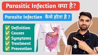 Parasitic Infection in Hindi  Causes Symptoms Prevention And Treatment of Parasite Infection [upl. by Lucinda]