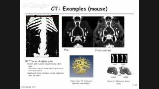 42  Computed tomography  Image reconstructionbackprojection [upl. by Cinelli138]