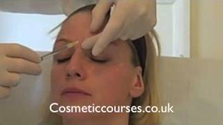 Botox training 3 Botox injection demonstration  Cosmetic Courses [upl. by Zorine]