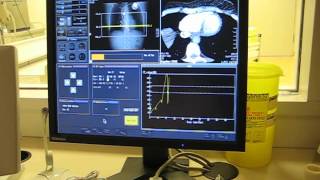 LIVE CT Cardiac on Aquilion ONE [upl. by Ardnasella529]