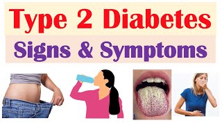 Type 2 Diabetes Signs amp Symptoms amp Why They Occur amp Associated Conditions [upl. by Naujad550]