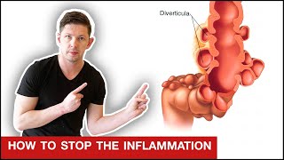 How to Fix Diverticulitis AS FAST AS POSSIBLE [upl. by As]