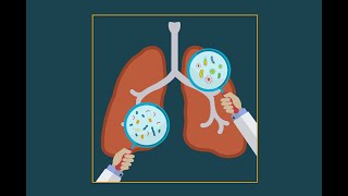 Pneumocystis jiroveci pneumonia pcp [upl. by Meehar832]