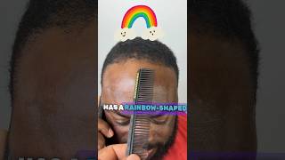 Rainbow Shaped Hairline fix 🌈💈 hairline haircut [upl. by Lenad]