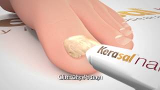 Kerasal Nail Restore Healthy Nail Appearance 30 Sec [upl. by Nuawad]