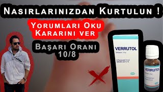 Nasırı Verrutol Yöntemiyle Geçirme \u00100 Çözüm [upl. by Narrad837]