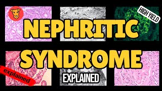 NEPHRITIC SYNDROME Pathogenesis of glomerular injury Mechanism of clinical symptoms USMLE Nephrology [upl. by Struve]