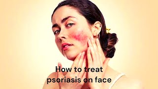 How to Treat Psoriasis on Face [upl. by Dalila558]