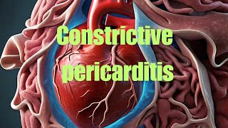 Constrictive pericarditis [upl. by Caiaphas678]