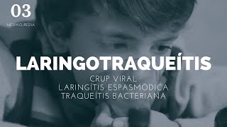 Laringotraqueitis  ENARM [upl. by Vona]